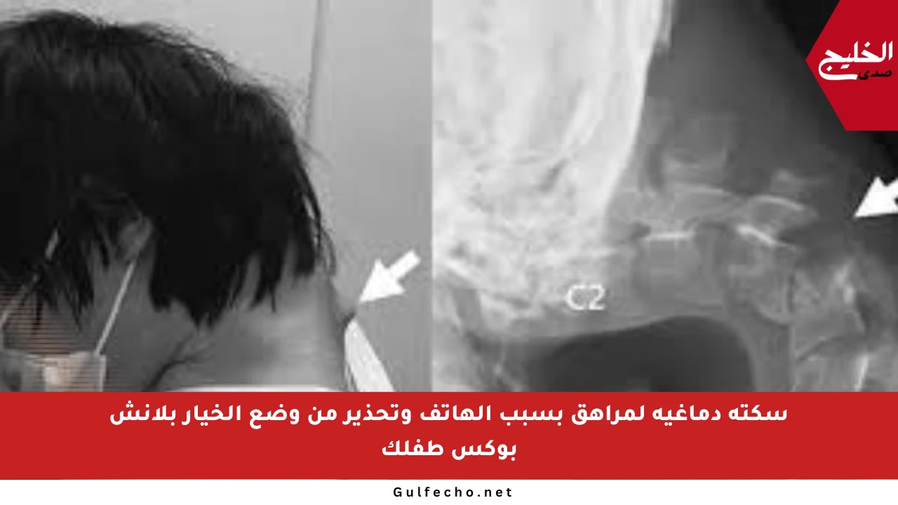سكتة دماغية لمراهق بسبب الهاتف وتحذير من وضع الخيار بلانش بوكس طفلك